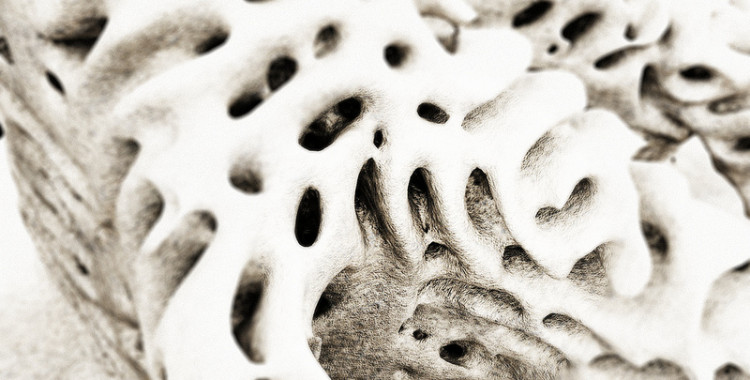 Reefs